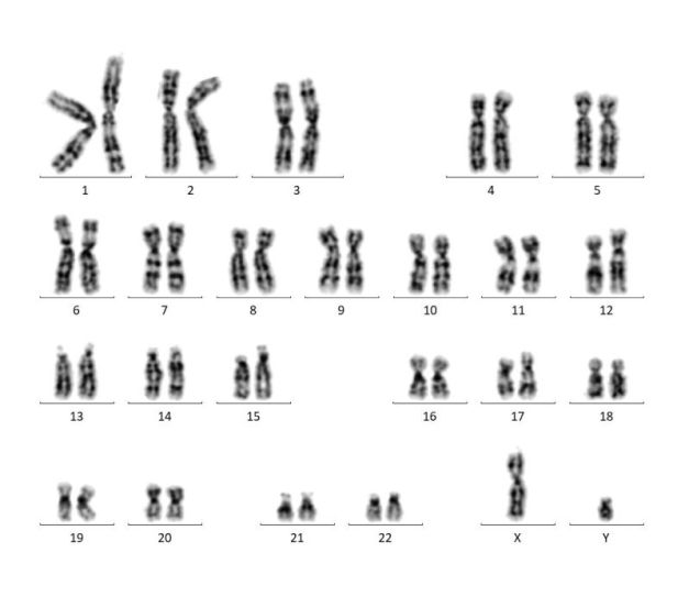 prawidłowy kariotyp męski