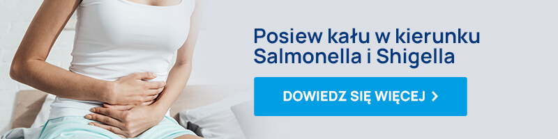 posiew kału w kierunku salmonella i shigella