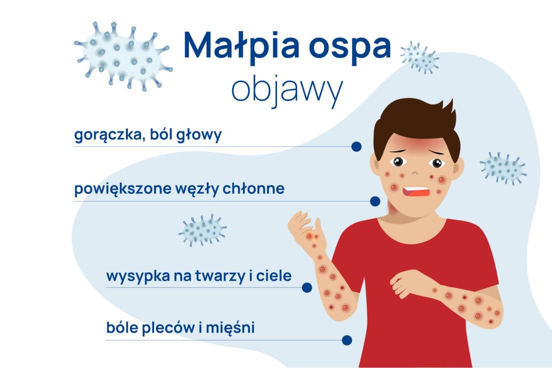 objawy małpiej ospy infografika