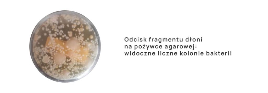 odcisk fragmentu dłoni na pożywce agarowej