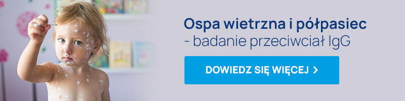 półpasiec i ospa wietrzna badanie przeciwciał baner