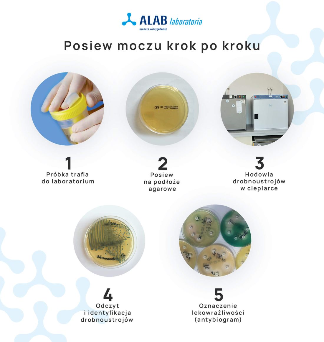 posiew moczu w laboratorium krok po kroku