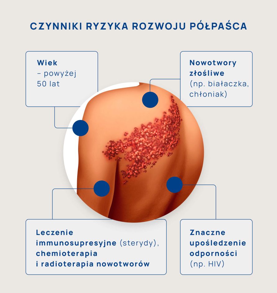 czynniki ryzyka rozwoju półpaśca infografika