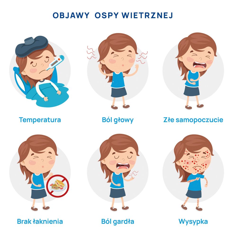 objawy ospy wietrznej infografika