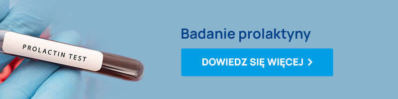 Badanie prolaktyny baner