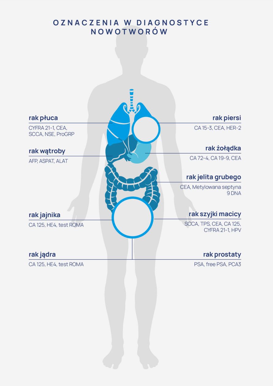 sugerowane markery nowotworowe w diagnostyce wybranych chorób nowotworowych - infografika