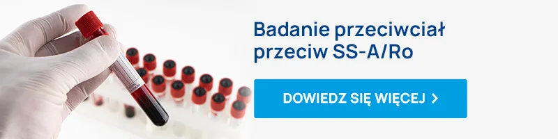 badanie przeciwciał anty ro-ss-a / przeciw SS-A/Ro baner