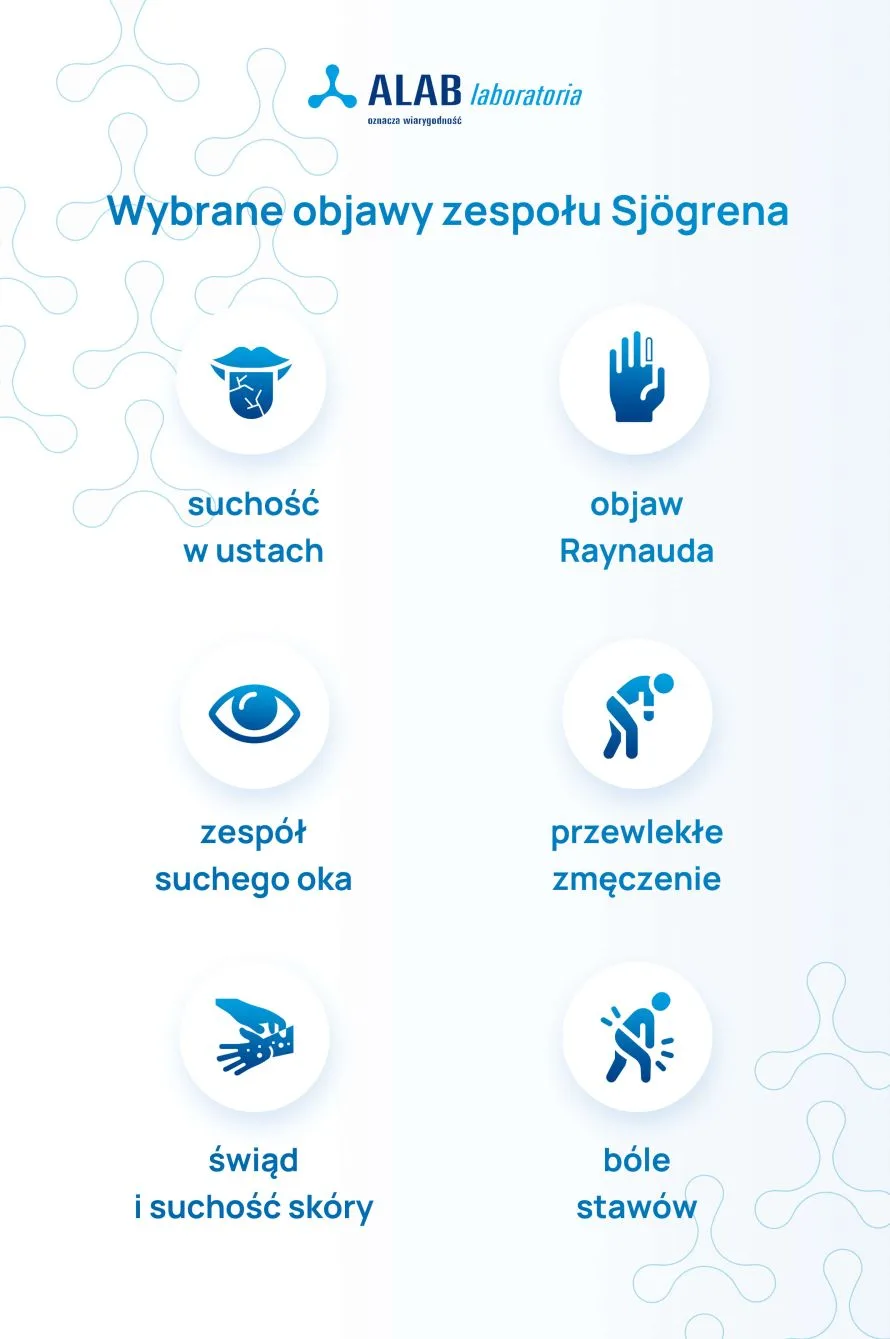 wybrane objawy zespołu Sjogrena infografika