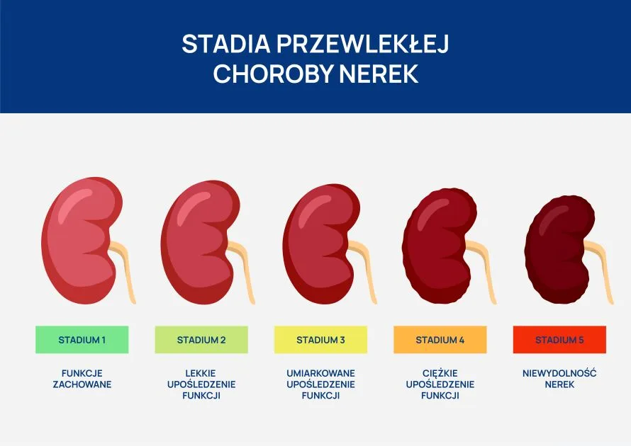 stadia przewlekłej choroby nerek infografika