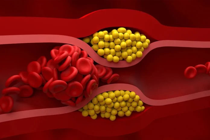 cholesterol nie-HDL