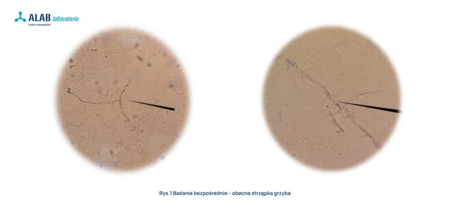 Grzybica - badanie bezpośrednie, obraz pod mikroskopem ALAB laboratoria