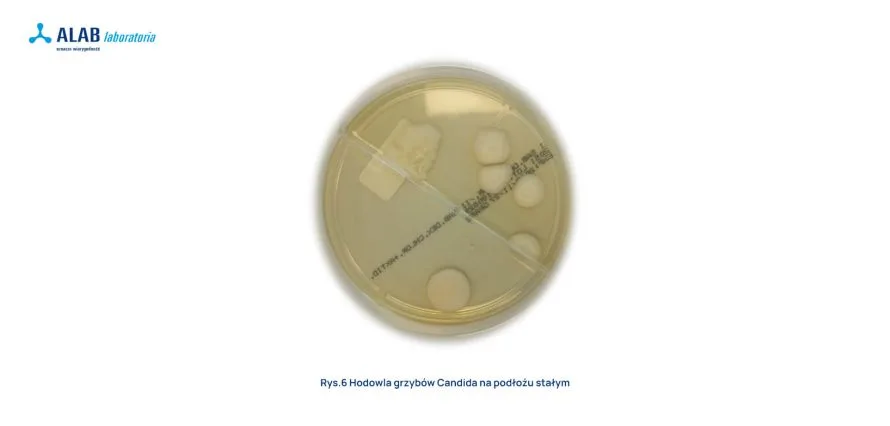 grzyby Candida hodowla na podłożu stałym