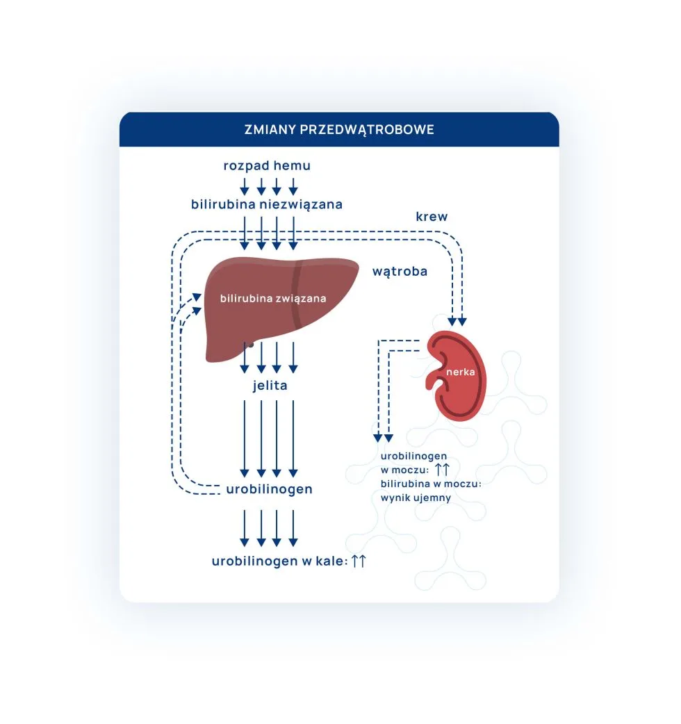 schemat 2 - zmiany przedwątrobowe