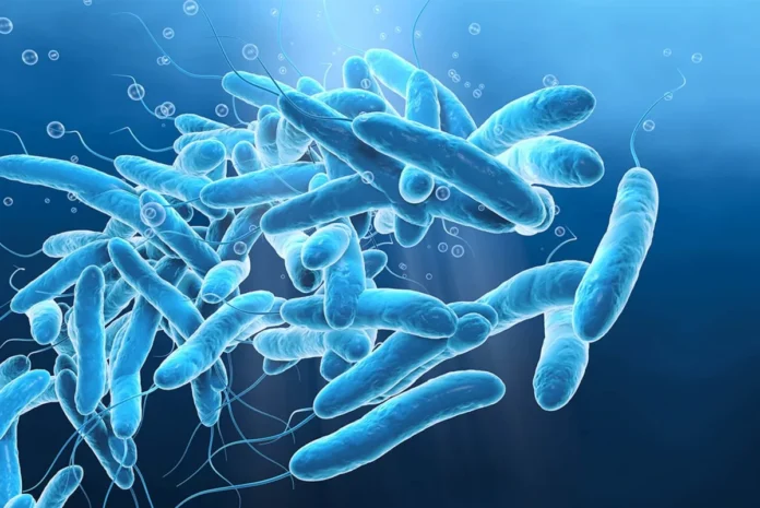 legionella