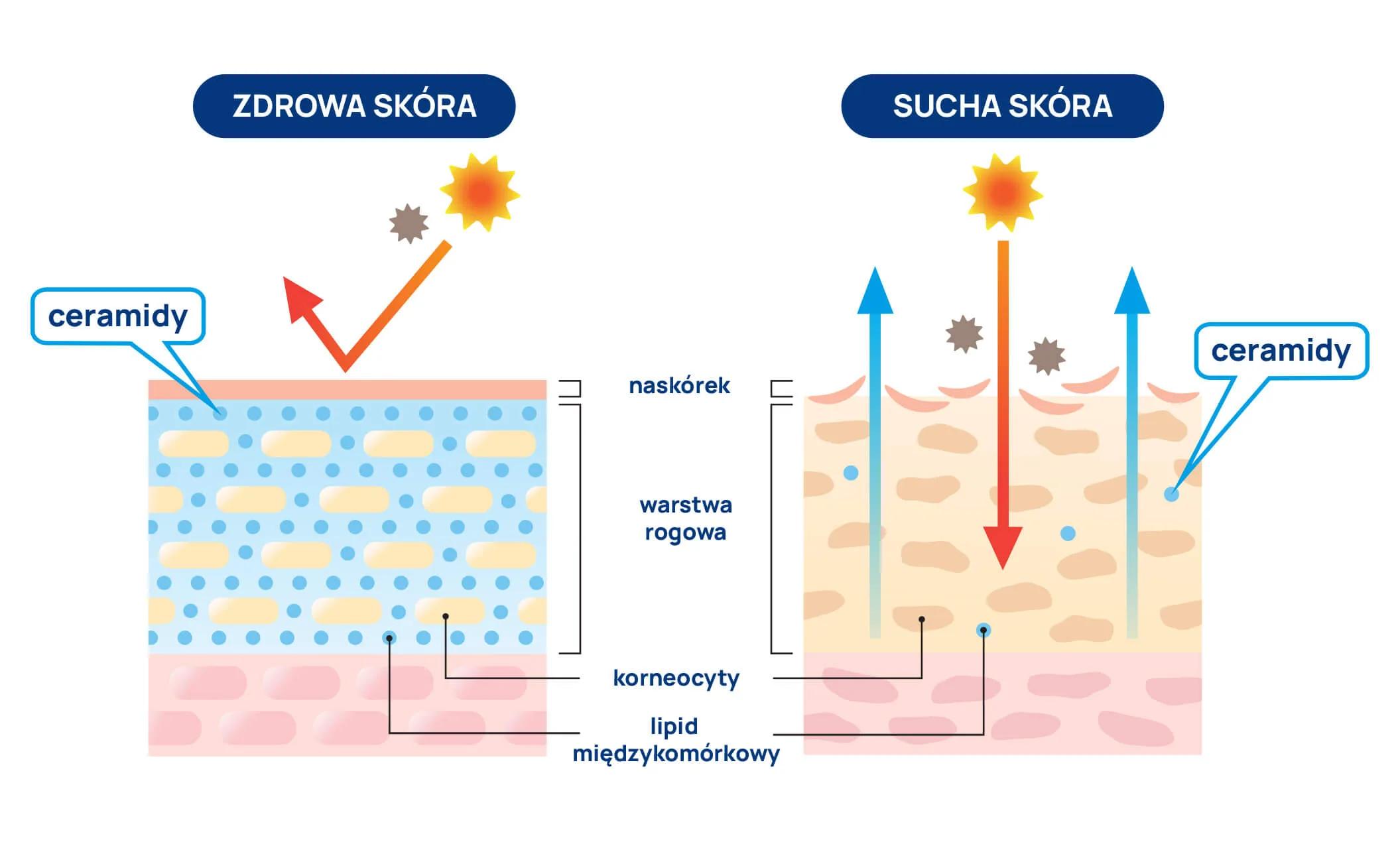 sucha skóra mechanizm powstawania infografika