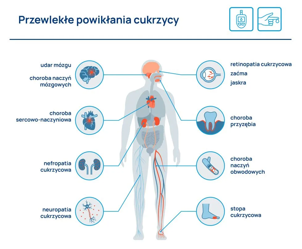 przewlekłe powikłania cukrzycy