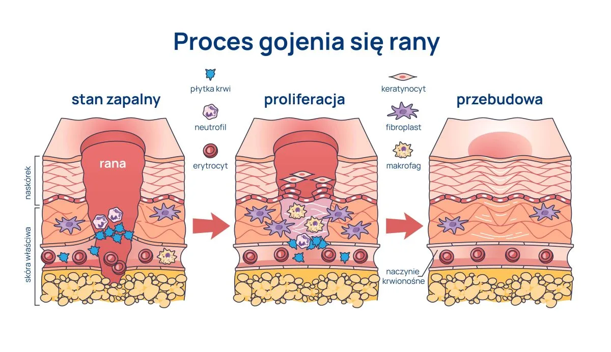 proces gojenia się rany infografika