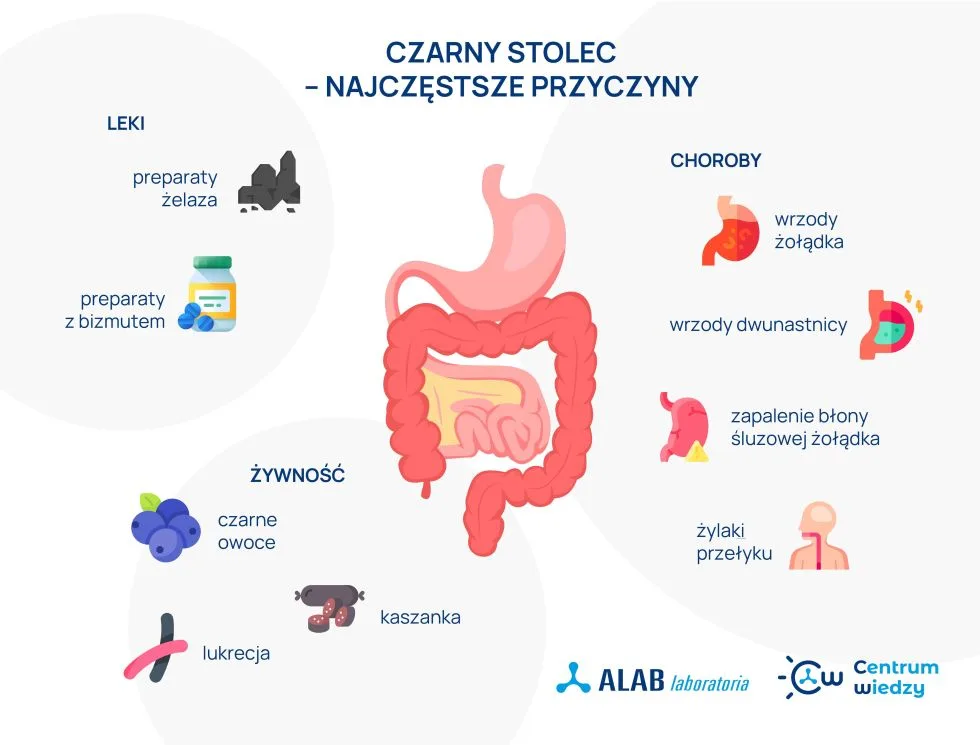 czarny stolec najczęstsze przyczyny infografika