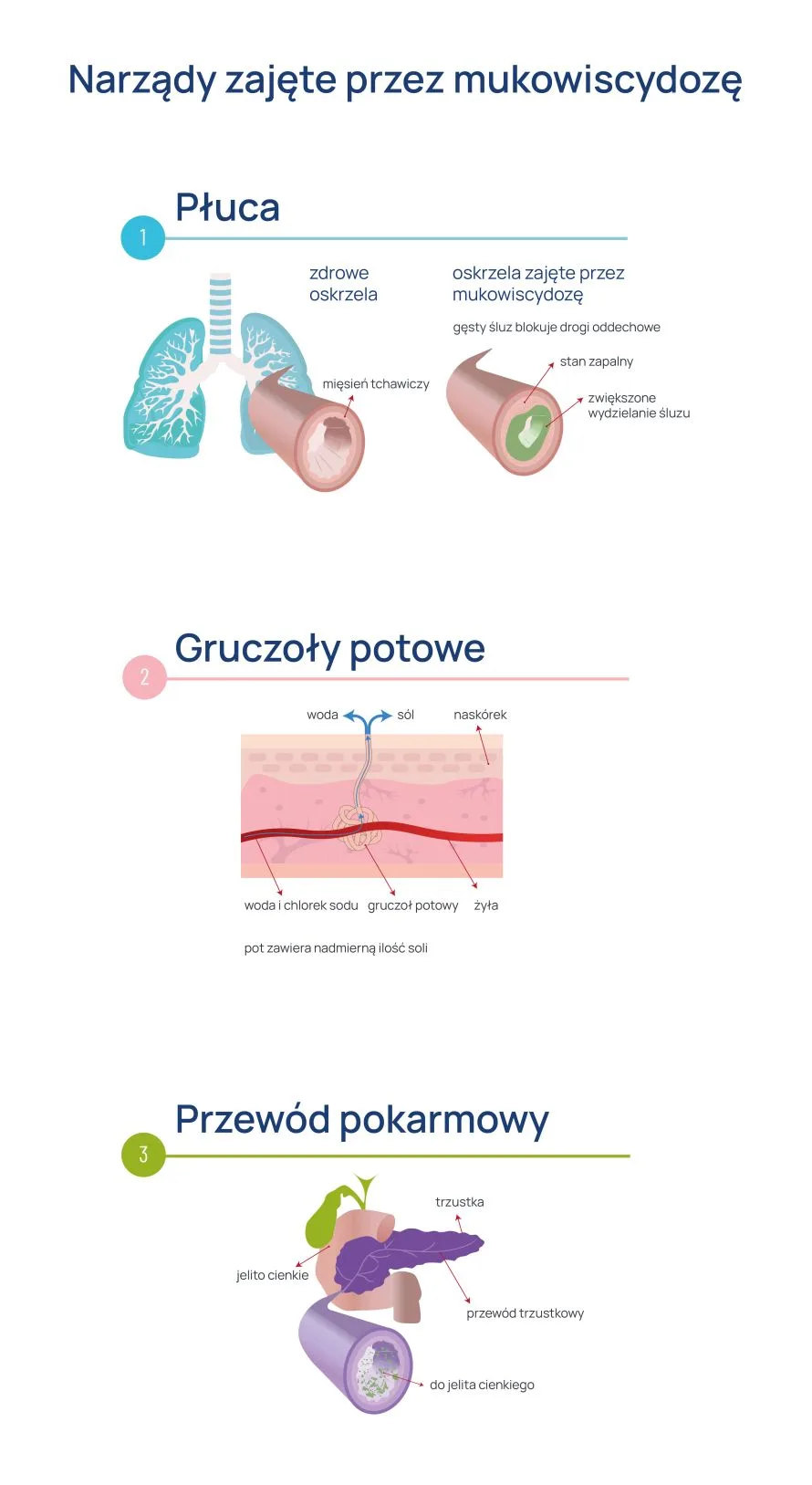 mukowiscydoza infografika objawy