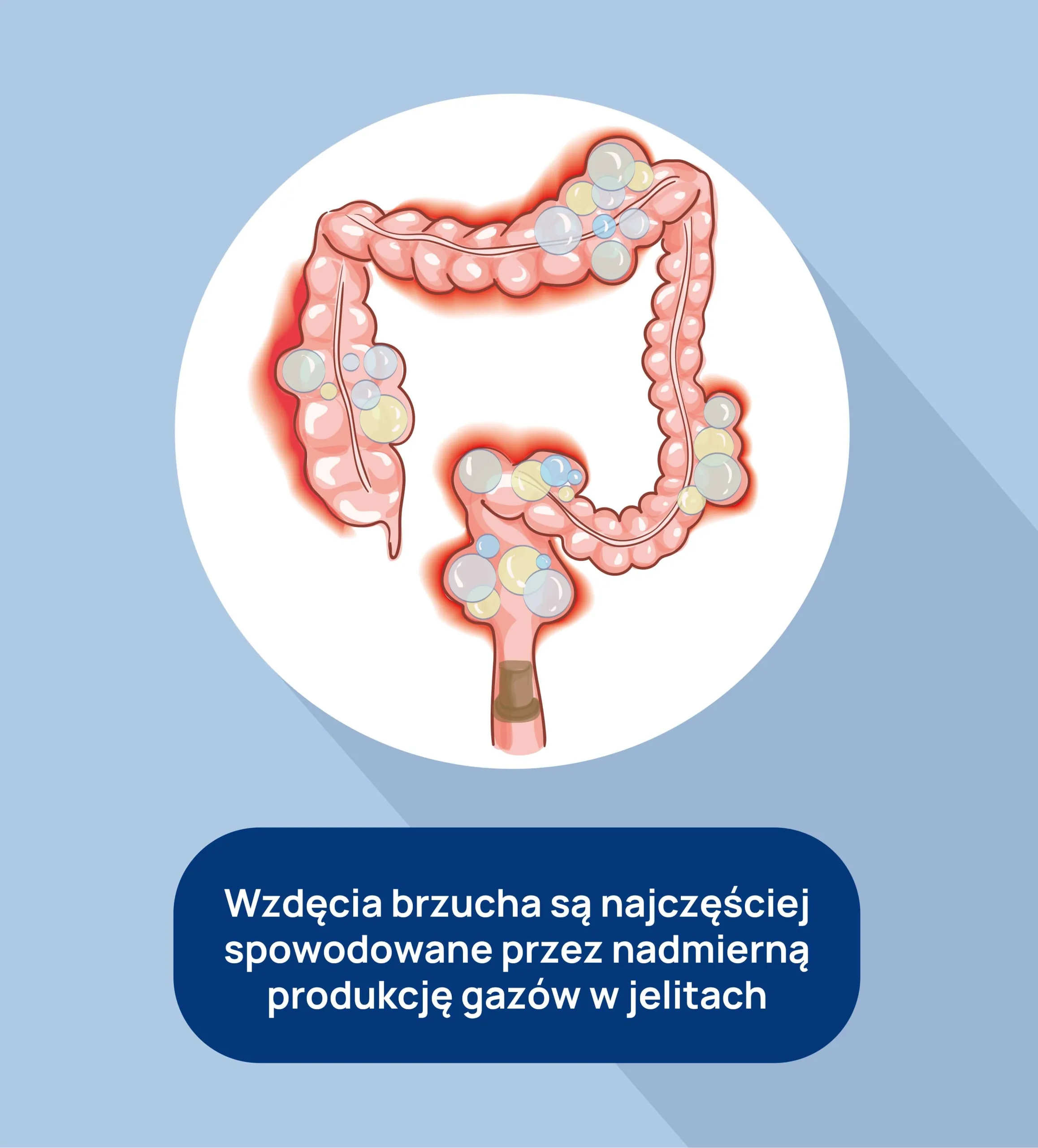 wzdęcia brzucha infografika