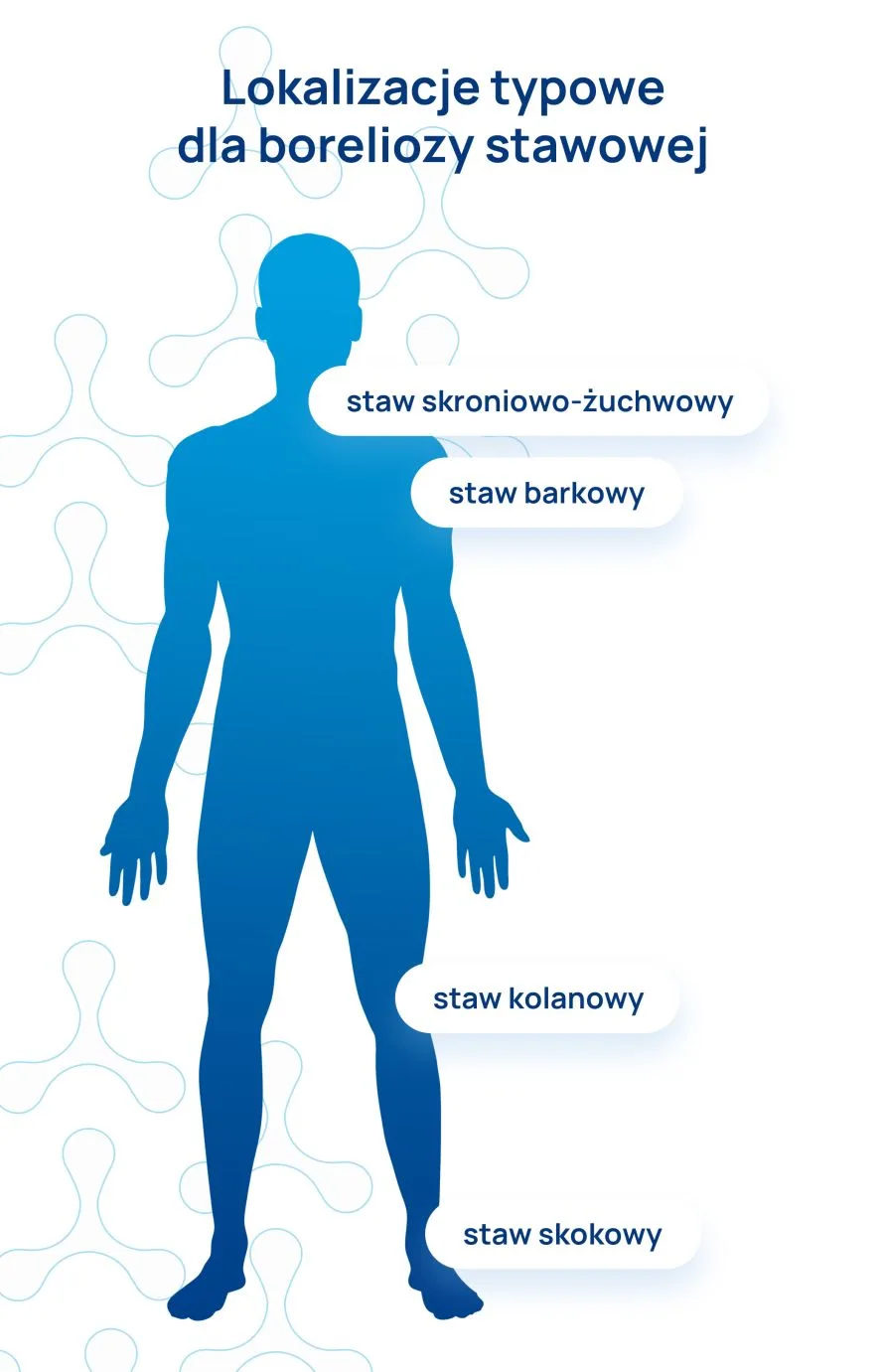 borelioza stawowa infografika