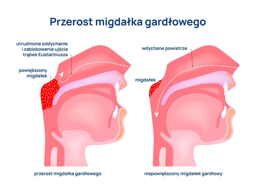 trzeci migdal infografika