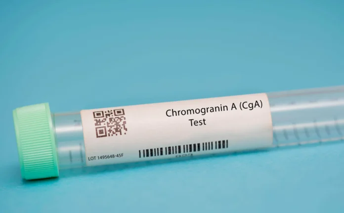 chromogranina