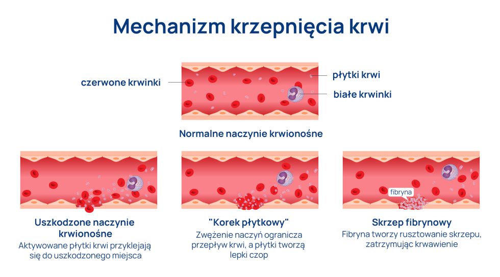 mechanizm krzepnięcia krwi infografika