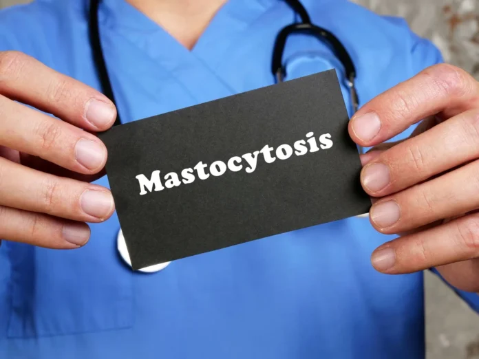 mastocytoza