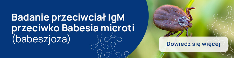 Badanie przeciwciał IgM przeciwko Babesia microti (babeszjoza)_